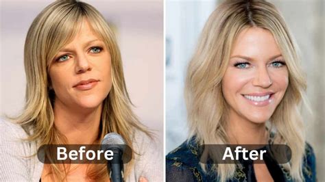 kaitlin olsen plastic surgery|Kaitlin Olson’s Plastic Surgery Rumors: What Has the。